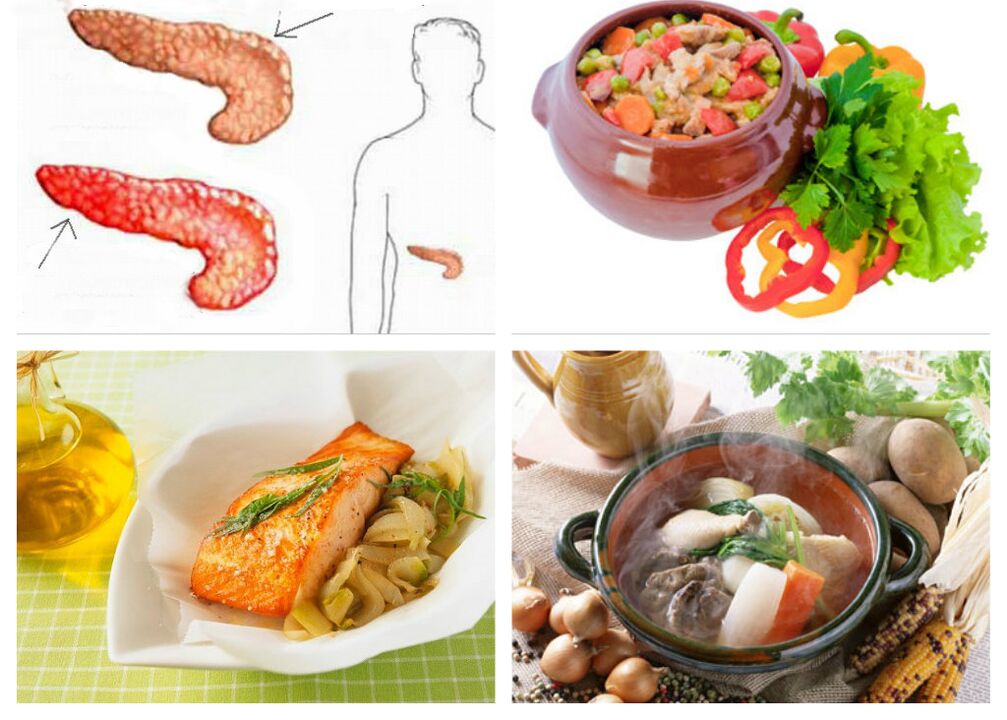 Dieet voor pancreatitis